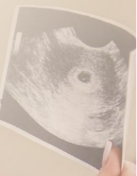 Fetal Encounter