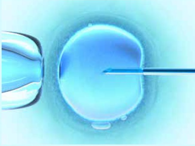 Social egg freezing